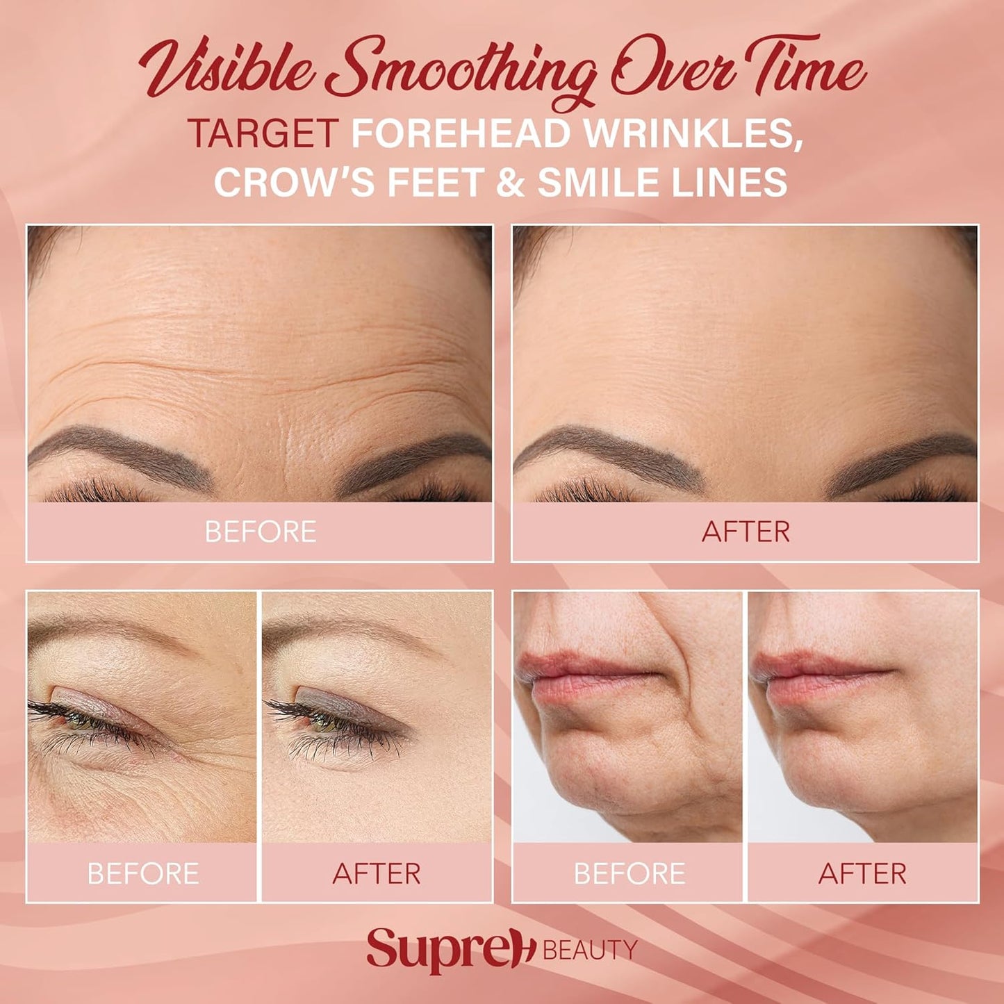 Facial Wrinkle Patches for Anti-Wrinkle: Smile Line Patches Under Eye and Forehead 3 in 1 Set - Overnight Easy Stay with Peptide Collagen 60 PCS