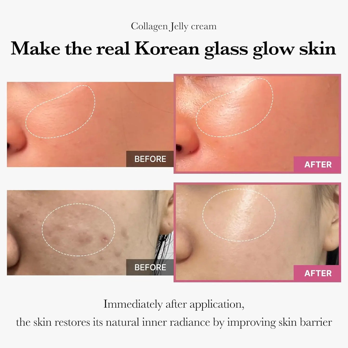 Hydrating Collagen Jelly Cream – Korean Glass Skin Moisturizer (110ml)