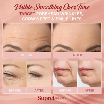 Facial Wrinkle Patches for Anti-Wrinkle: Smile Line Patches Under Eye and Forehead 3 in 1 Set - Overnight Easy Stay with Peptide Collagen 60 PCS