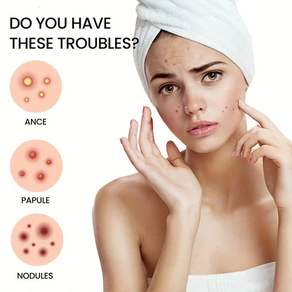 Patch for Pimples and Blemishes – Spot Stickers for Face & Skin