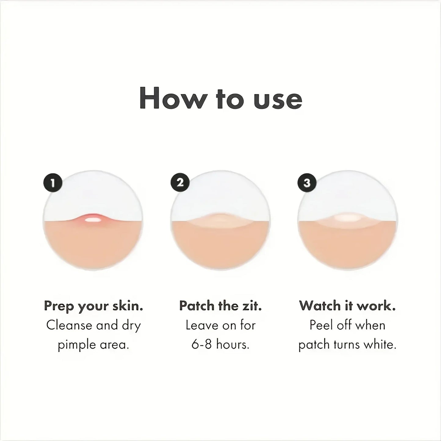 Patch for Pimples and Blemishes – Spot Stickers for Face & Skin