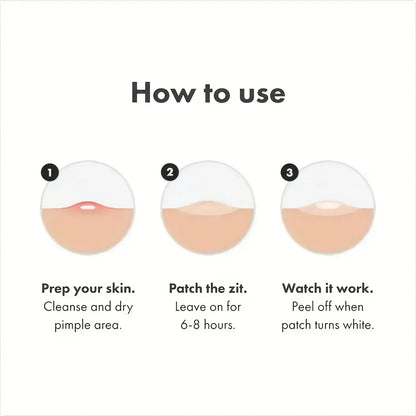 Patch for Pimples and Blemishes – Spot Stickers for Face & Skin
